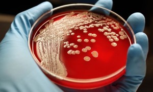 ZNANSTVENICI: Apokaliptična Prijetnja – Antibiotici u Budućnosti Postaju Nemoćni