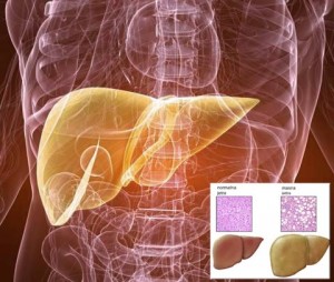 Masna jetra može biti opasna: Evo kako da uvek budete zdravi