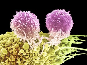 LIJEK SE KRIJE U VAMA: Znanstvenici otkrili kako tijelo samo može uništiti kancerogene tumore – Bez potrebe za lijekovima