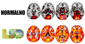 ZNANSTVENICI SNIMILI MOZAK LJUDI NA LSD-U. REZULTATI SU BILI REVOLUCIONARNI