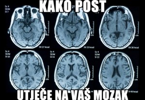 DANAS NEMOJTE VIŠE JESTI: Neuroznanstvenik pokazuje što POST radi vašem mozgu