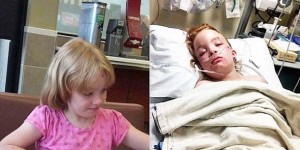 Djevojčica ostala paralizirana nakon rutinskog cijepljenja protiv gripe