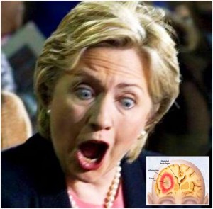 Hillary Clinton ima tumor na mozgu! (VIDEO)