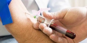 Znanstvenici razvili najnoviji test krvi koji će vam dijagnosticirati rak iako ga još nemate