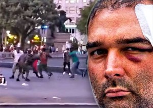 ‘ŠPANJOLSKA JE POSTALA ZEMLJA TREĆEG SVIJETA’: Progovorio američki turist napadnut u Barceloni od strane imigranata