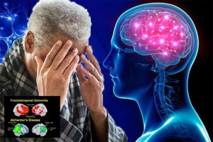Slučajno otkriven lijek protiv ‘Alzheimera’