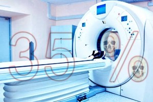 Jeste li znali da liječnički pregled CT-om povećava vaše šanse za dobivanjem raka za čak 35 posto?