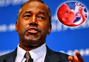 Dr. Ben Carson: Da, bebe osjećaju stravičnu bol kada ih trgaju tijekom ‘barbarskog’ pobačaja